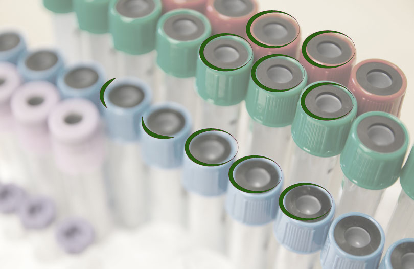 Взаимосвязь вероятности летального исхода в результате коронавируса и группы крови заболевшего