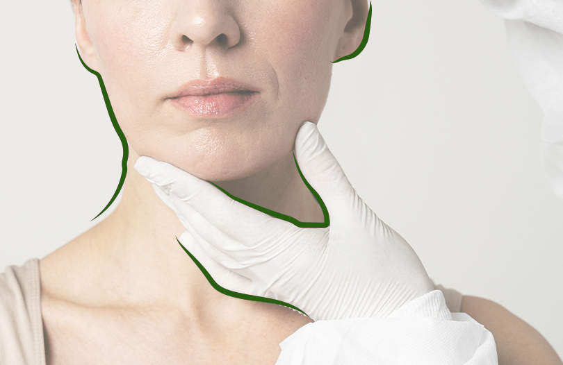 Реконструкция лица умершего человека