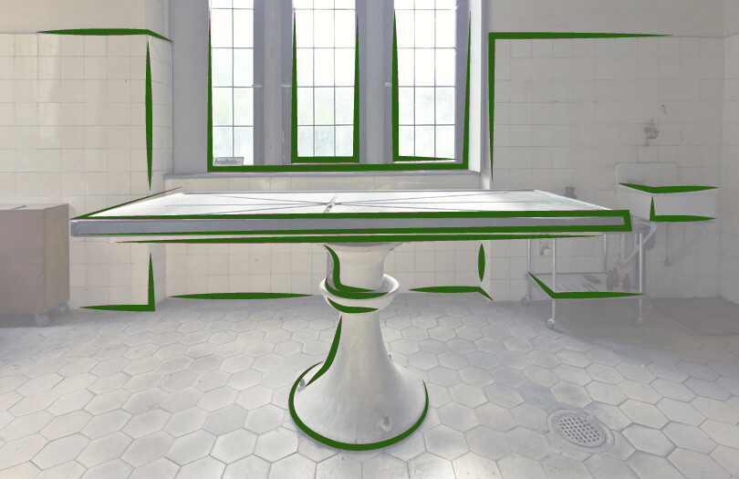 Что такое патологоанатомическое вскрытие?