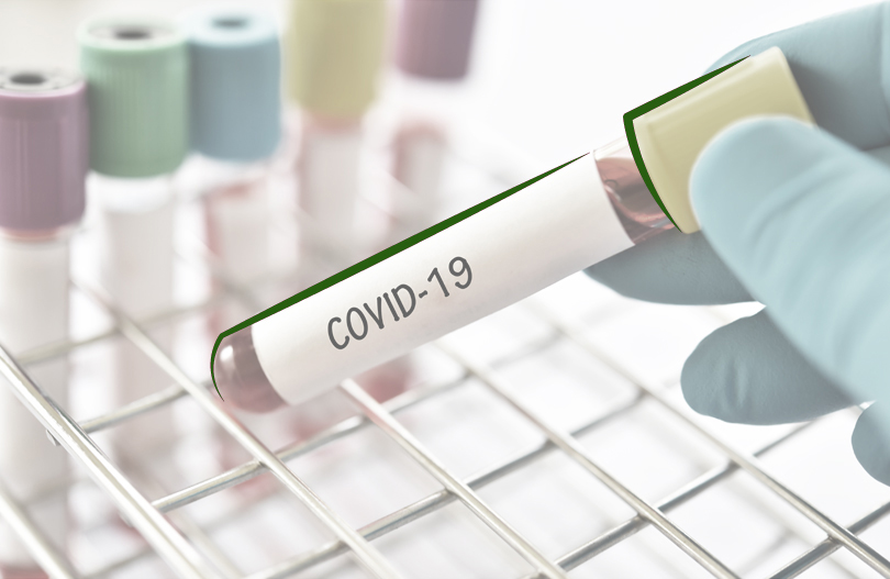 Страховые выплаты в случае смерти застрахованного от COVID-19