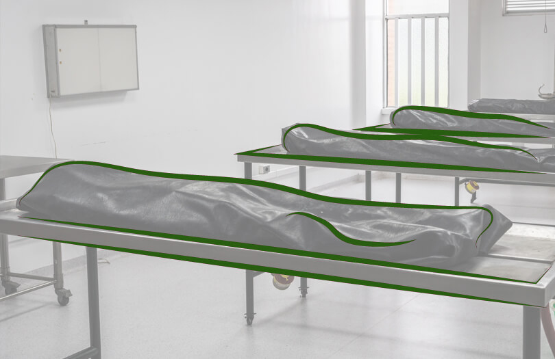 Вскрытие тела в морге